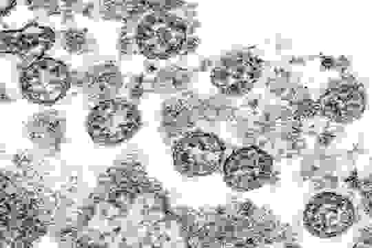 Image of spherical coronavirus particles from the first U.S. case of COVID-19