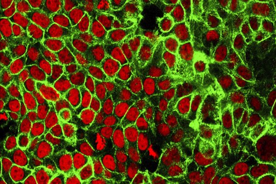 cancer cells