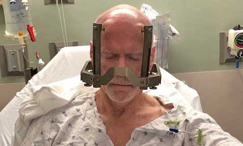 Dr. Ragle sits with a metal “frame” around his head to help surgeons map out the main incision